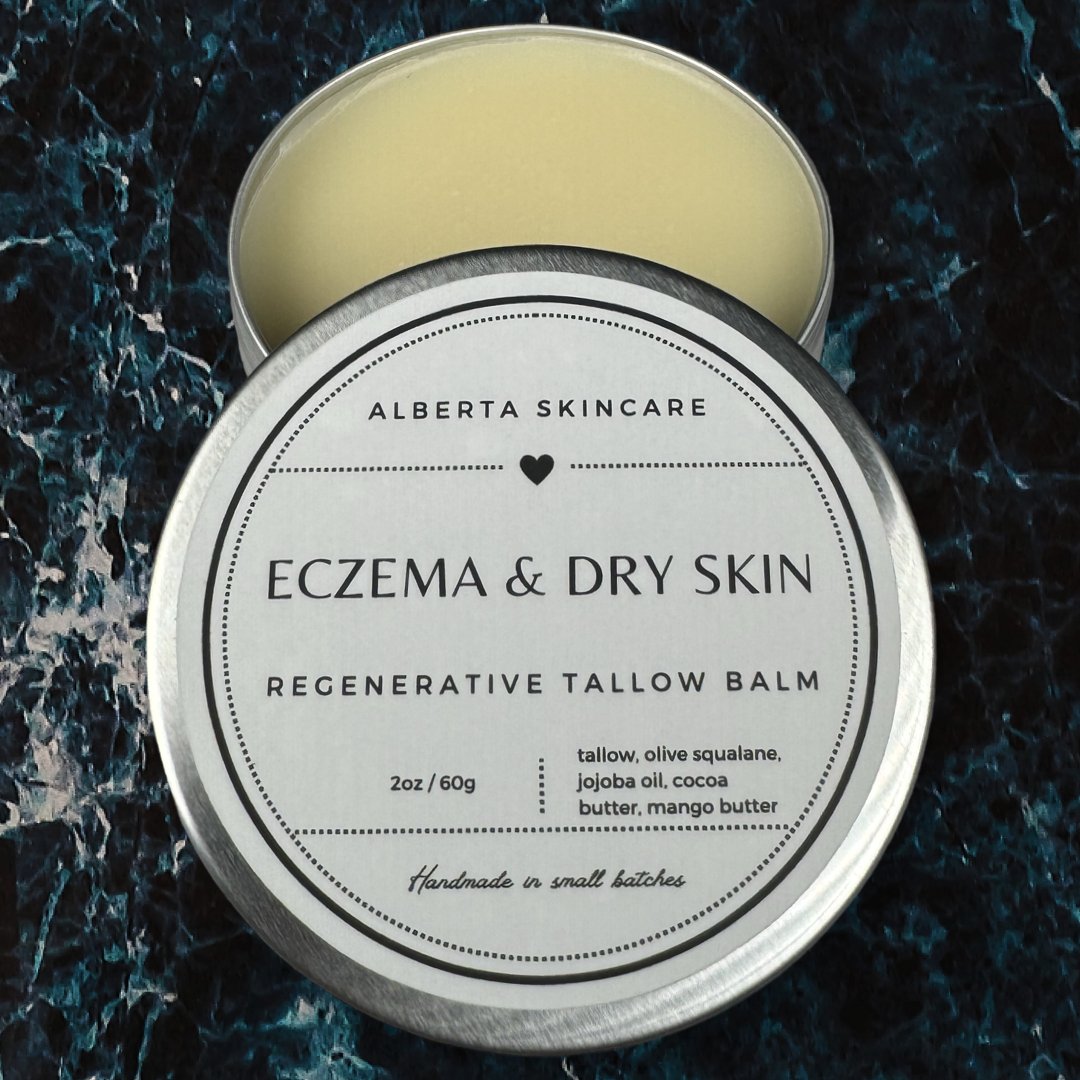 Eczema Balm - Alberta Skincare