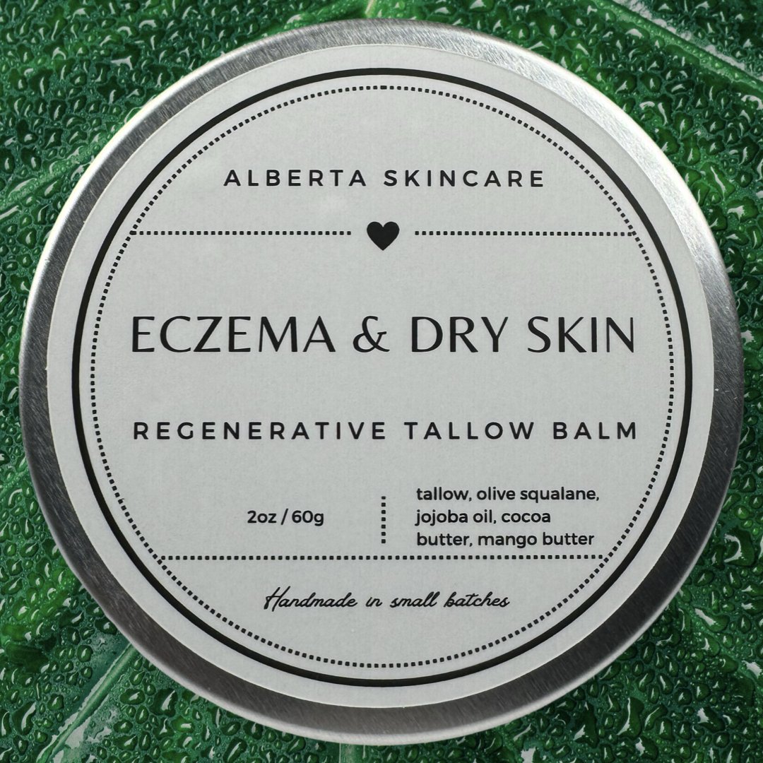 Eczema Balm - Alberta Skincare